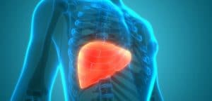 Zápal pečene - hepatitída