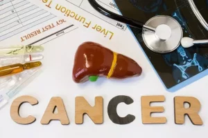 Model ľudskej pečene, laboratórne skúmavky, lekárska dokumentácia a nápis „CANCER“ – znázornenie problematiky nádorov pečene a ich diagnostiky.