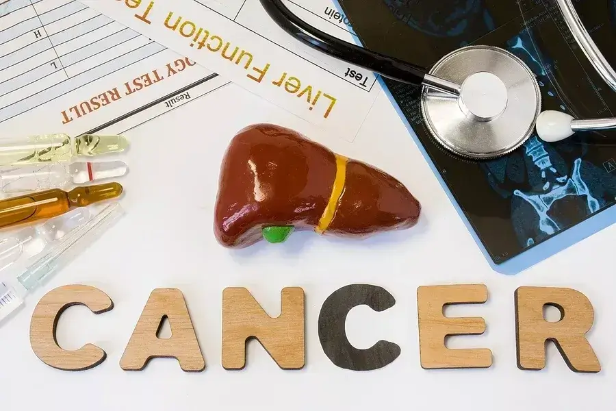 Model ľudskej pečene, laboratórne skúmavky, lekárska dokumentácia a nápis „CANCER“ – znázornenie problematiky nádorov pečene a ich diagnostiky.