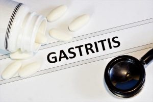 Gastritída